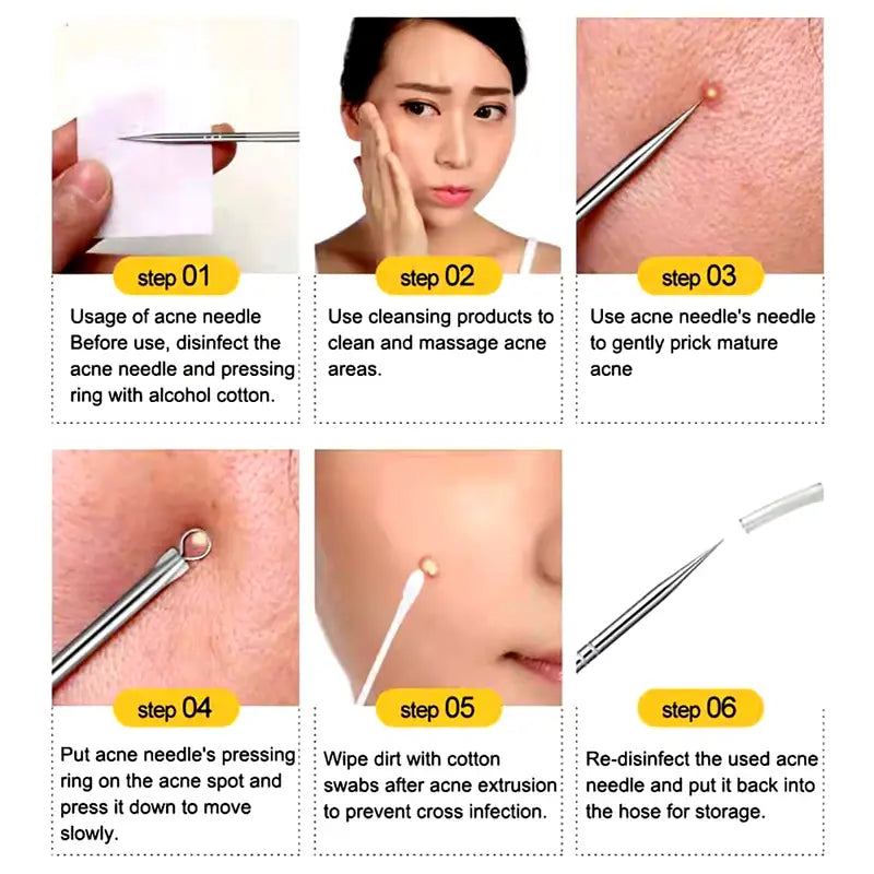 4 Pcs Blackhead Acne Remover Facial Care Tools