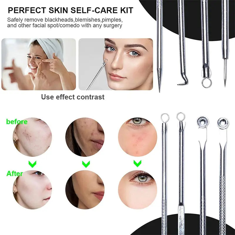 4 Pcs Blackhead Acne Remover Facial Care Tools