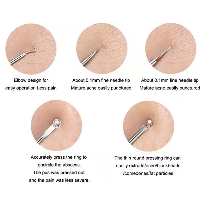 4 Pcs Blackhead Acne Remover Facial Care Tools